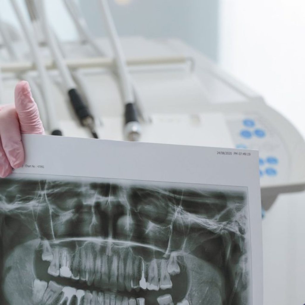 Dentist examining a patient during an oral cancer screening A dentist carefully examining a patient's mouth during an oral cancer screening