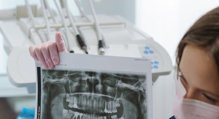 The Role of a Dentist in Oral Cancer Treatment, Explained in Detail
